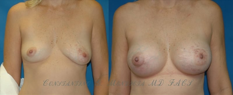 Before and After Image