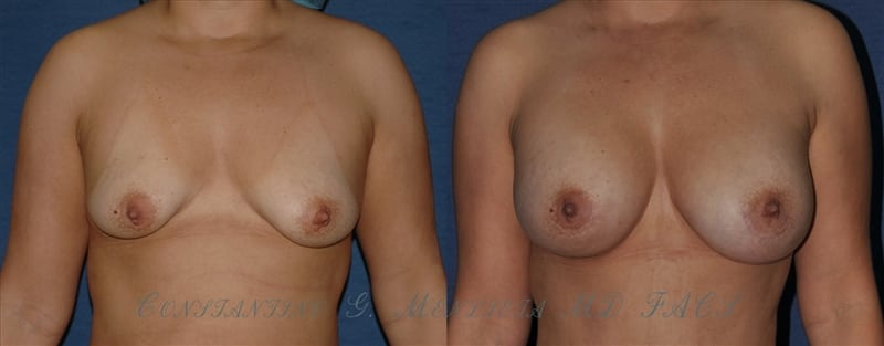 Before and After Image