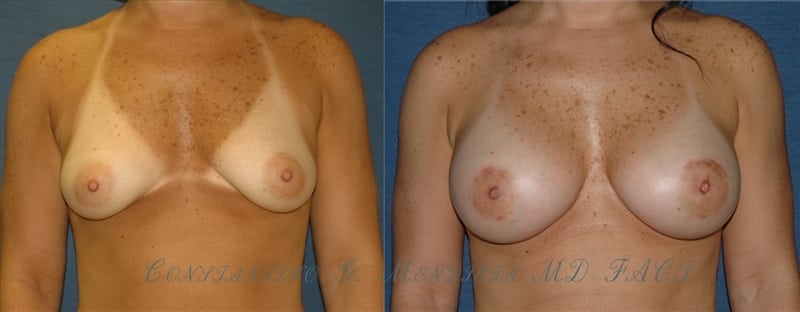 Before and After Image