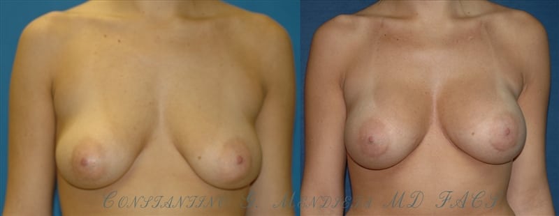 Before and After Image