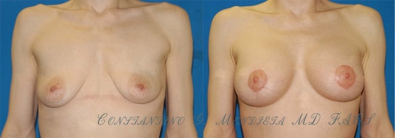 Before and After Image