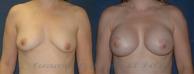 Before and After Image
