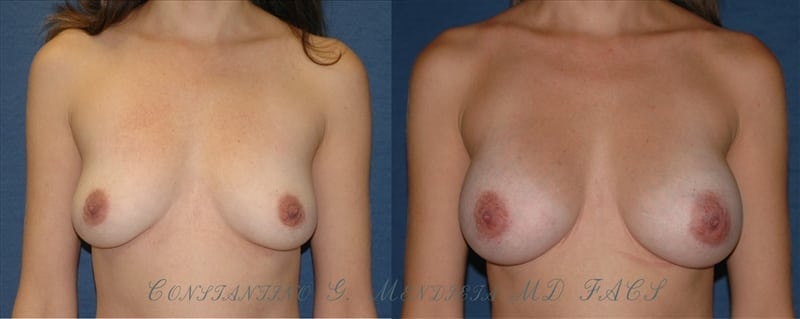 Before and After Image