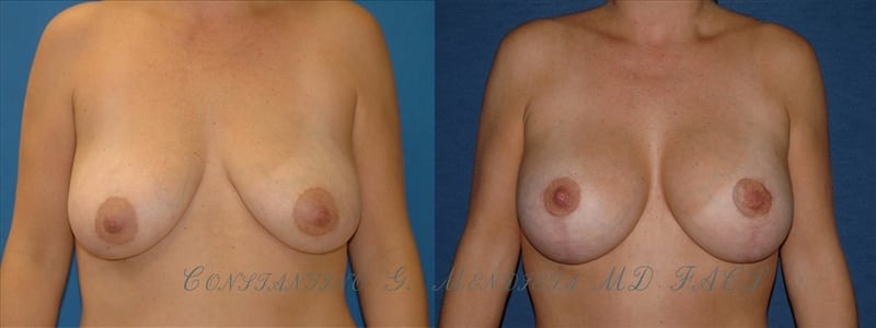 Before and After Image