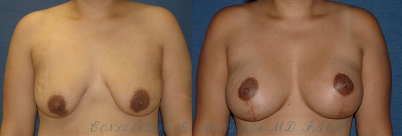 Before and After Image