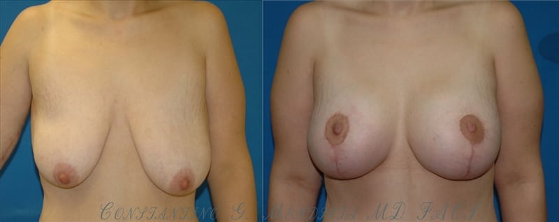 Before and After Image