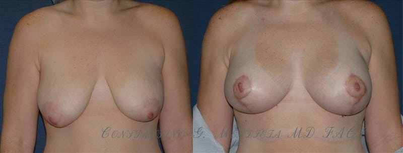 Before and After Image