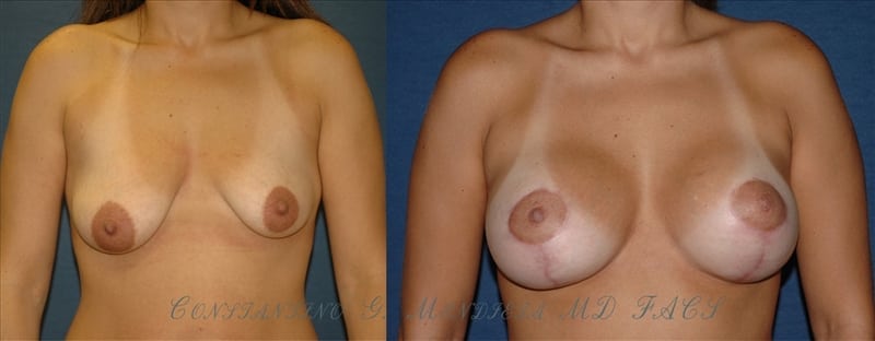 Before and After Image