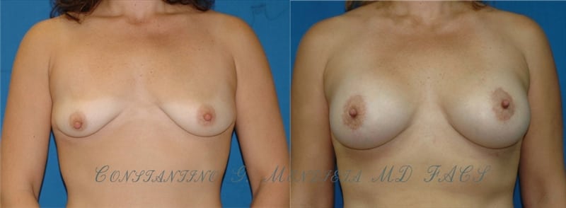 Before and After Image