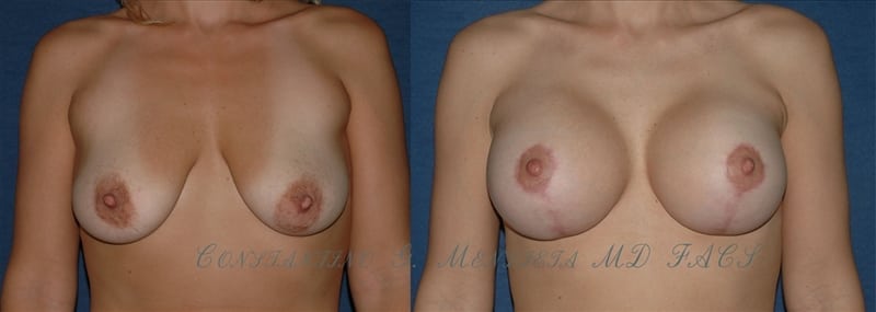 Before and After Image