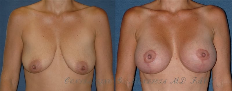 Before and After Image