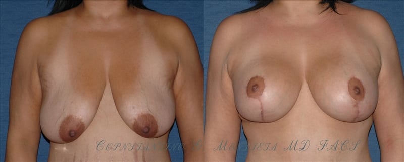 Before and After Image
