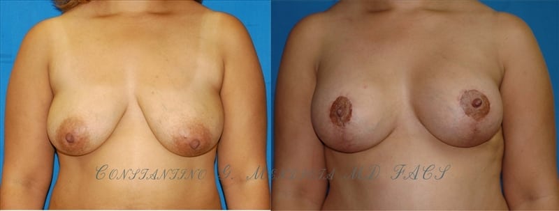 Before and After Image
