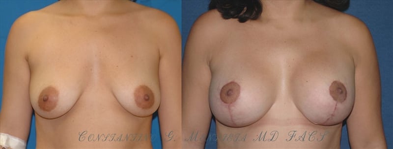 Before and After Image