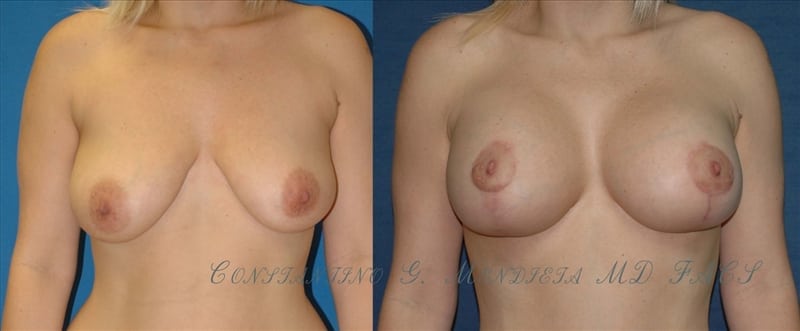 Before and After Image