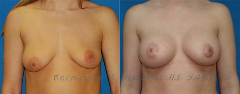 Before and After Image