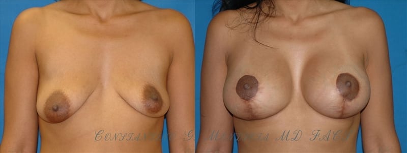 Before and After Image