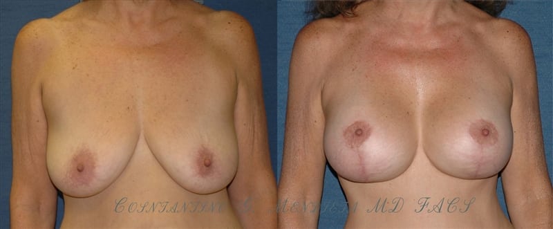Before and After Image