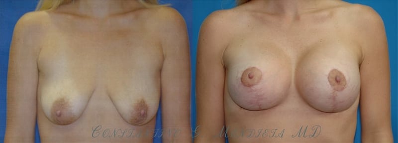 Before and After Image