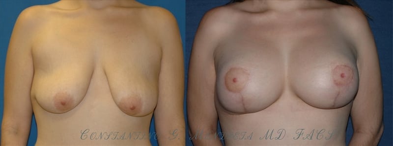Before and After Image