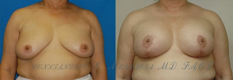 Before and After Image