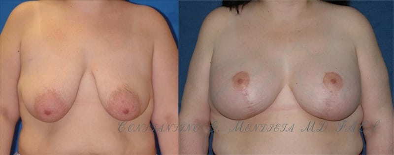 Before and After Image