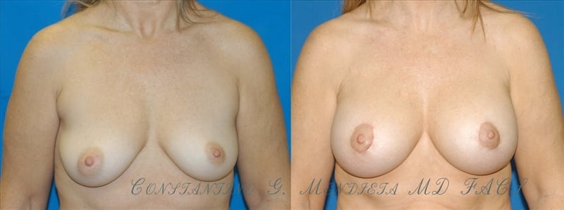 Before and After Image