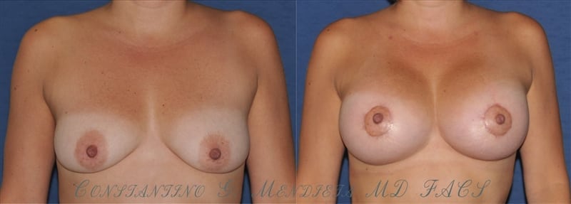 Before and After Image