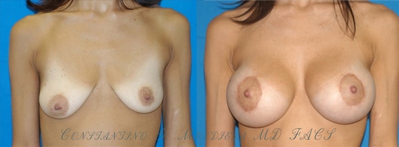 Before and After Image