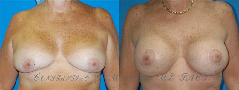Before and After Image