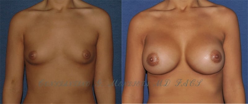 Before and After Image