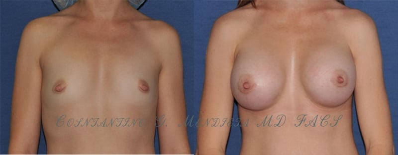 Before and After Image
