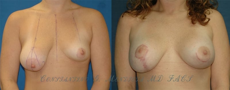 Before and After Image