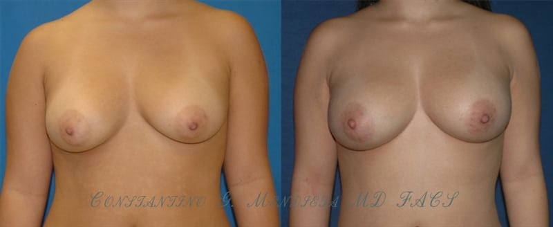 Before and After Image