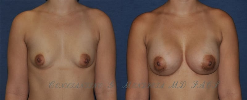 Before and After Image