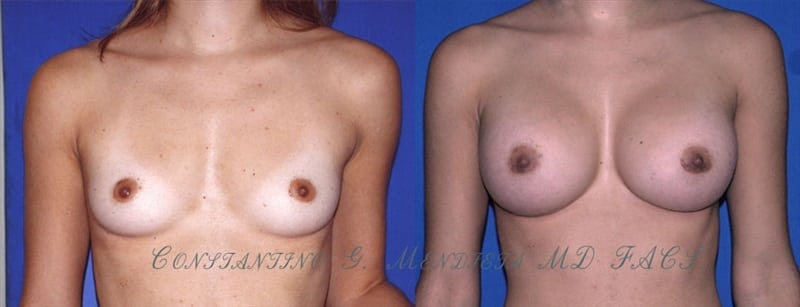 Before and After Image