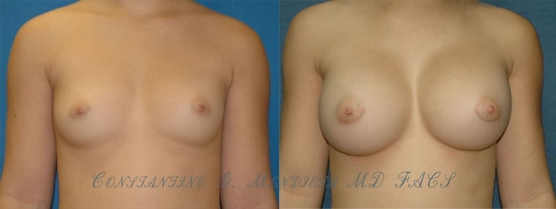 Before and After Image