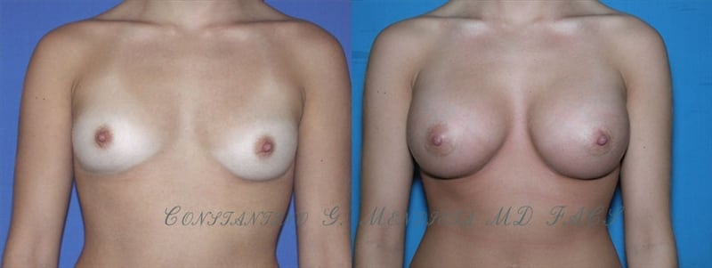 Before and After Image