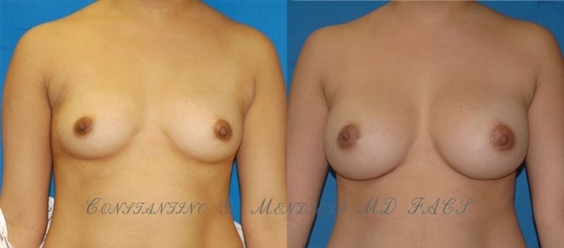 Before and After Image