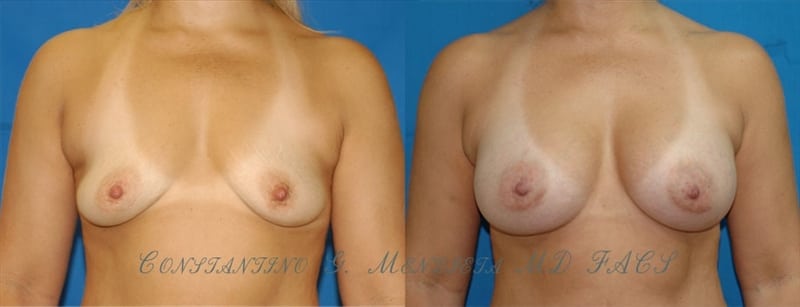 Before and After Image