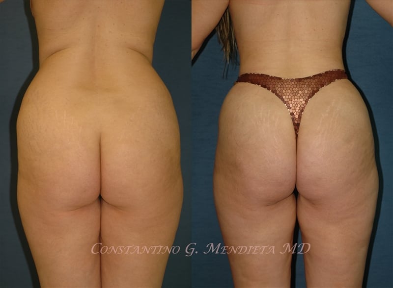 Before and After Image