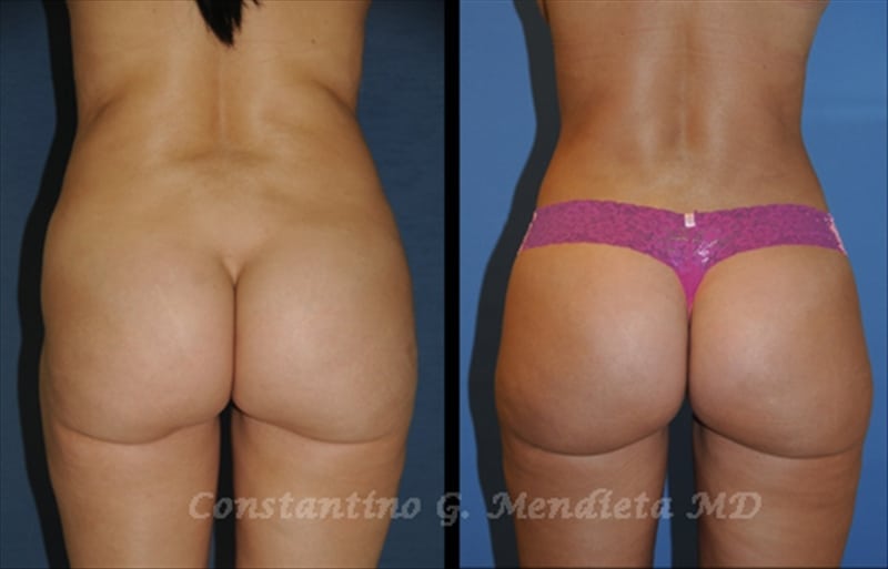 Before and After Image
