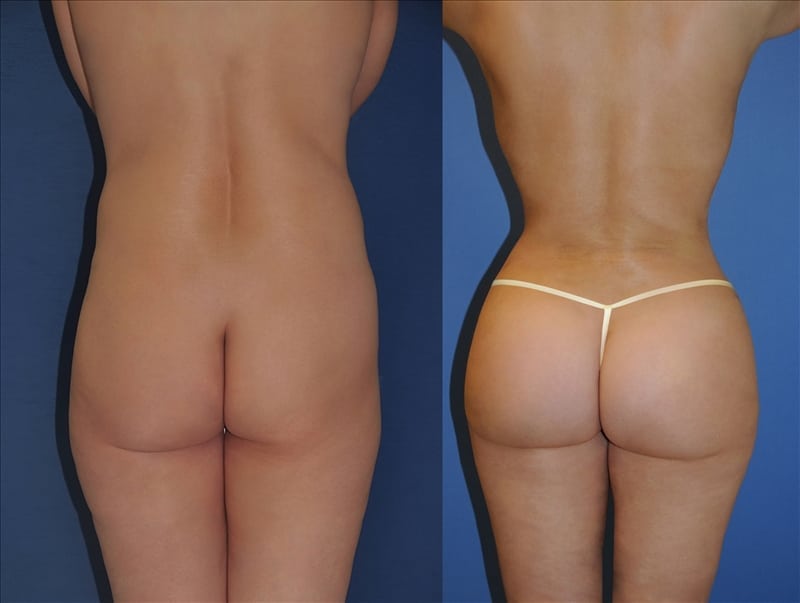 Before and After Image