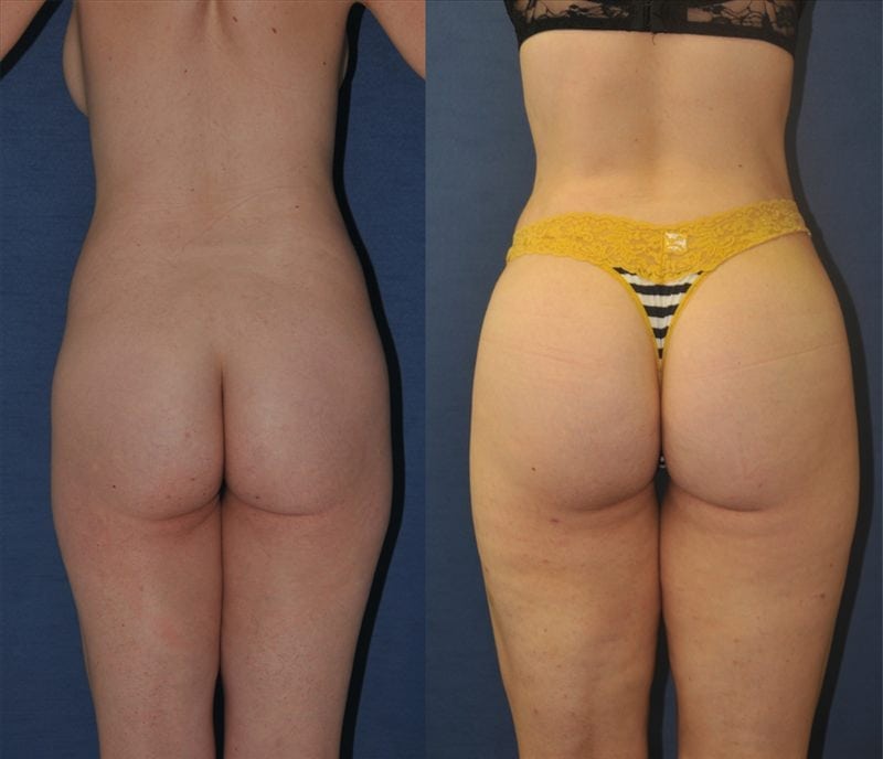 Before and After Image