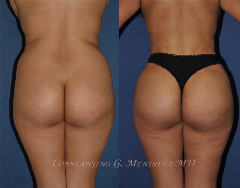 Before and After Image