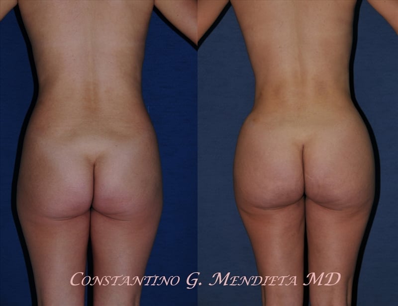 Before and After Image