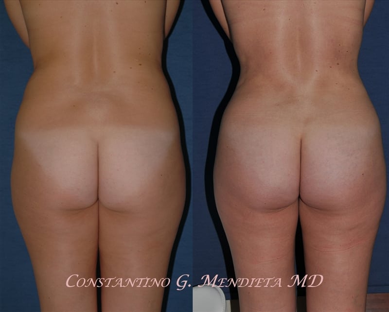 Before and After Image