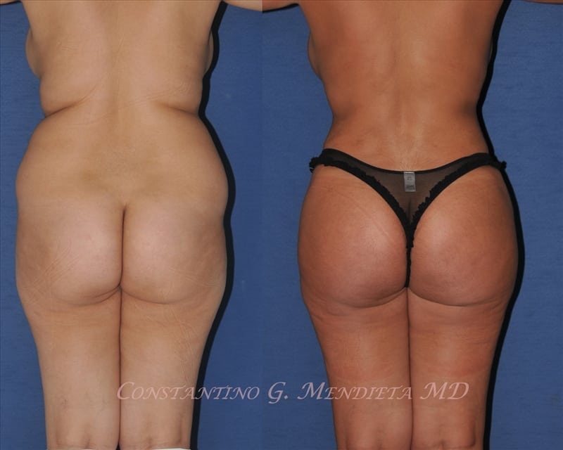 Before and After Image