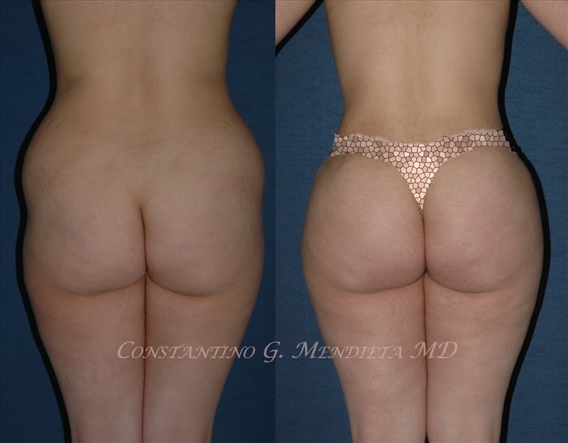 Before and After Image