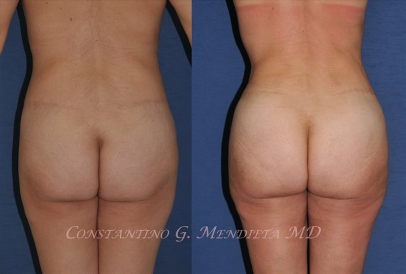 Before and After Image